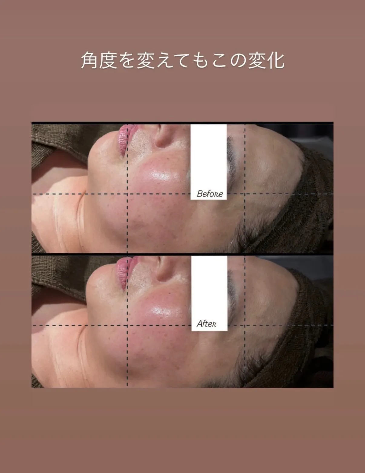 フェイシャル